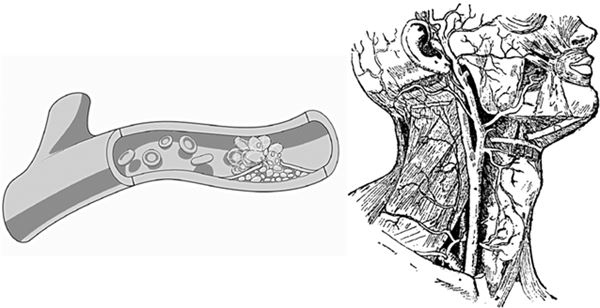 Иллюстрация к книге — По голове себе постучи. Вся правда о мигрени и другой головной боли [i_019.jpg]