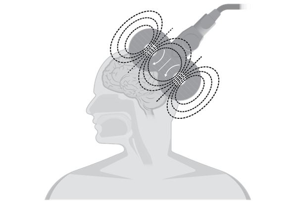 Иллюстрация к книге — По голове себе постучи. Вся правда о мигрени и другой головной боли [i_067.jpg]