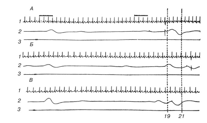 Иллюстрация к книге — Эмоциональный мозг [i_001.jpg]