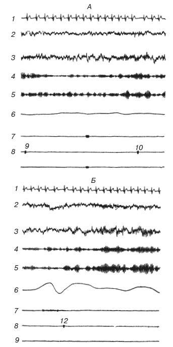 Иллюстрация к книге — Эмоциональный мозг [i_006.jpg]