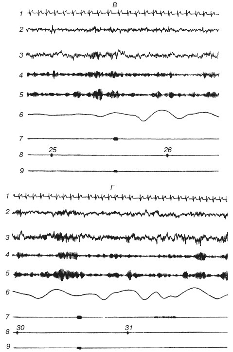 Иллюстрация к книге — Эмоциональный мозг [i_007.jpg]