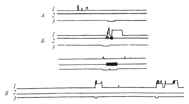 Иллюстрация к книге — Эмоциональный мозг [i_012.jpg]