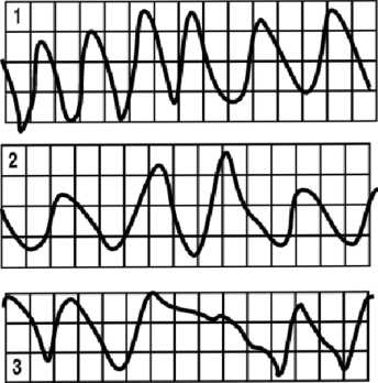 Иллюстрация к книге — Детектор лжи [i_033.jpg]