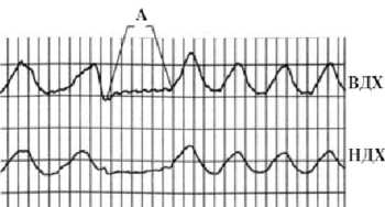 Иллюстрация к книге — Детектор лжи [i_068.jpg]
