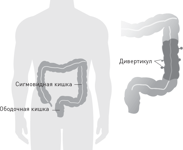 Иллюстрация к книге — Лжецы. Как врачи обманываются сами и невольно обманывают пациентов [i_046.jpg]