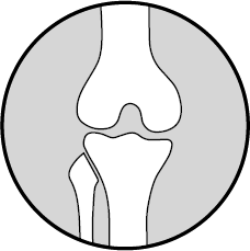 Иллюстрация к книге — Колени. Как у вас дела? Как ухаживать за одним из самых уязвимых суставов и не пропустить проблемы [i_001.jpg]