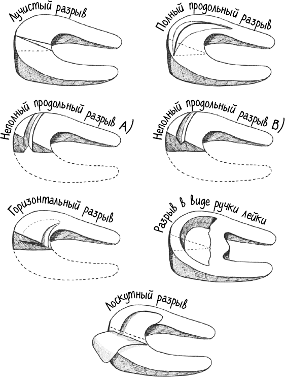 Иллюстрация к книге — Колени. Как у вас дела? Как ухаживать за одним из самых уязвимых суставов и не пропустить проблемы [i_004.jpg]