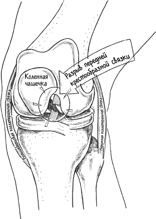 Иллюстрация к книге — Колени. Как у вас дела? Как ухаживать за одним из самых уязвимых суставов и не пропустить проблемы [i_005.jpg]