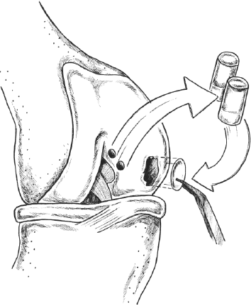 Иллюстрация к книге — Колени. Как у вас дела? Как ухаживать за одним из самых уязвимых суставов и не пропустить проблемы [i_006.jpg]