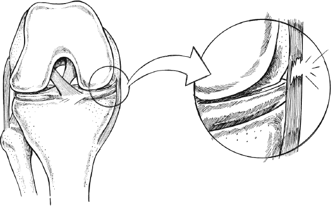 Иллюстрация к книге — Колени. Как у вас дела? Как ухаживать за одним из самых уязвимых суставов и не пропустить проблемы [i_007.jpg]