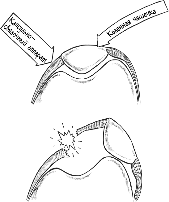 Иллюстрация к книге — Колени. Как у вас дела? Как ухаживать за одним из самых уязвимых суставов и не пропустить проблемы [i_009.jpg]