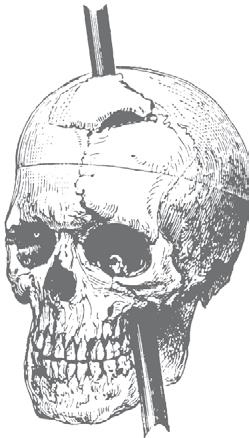 Иллюстрация к книге — Взламывая психиатрию [i_043.jpg]