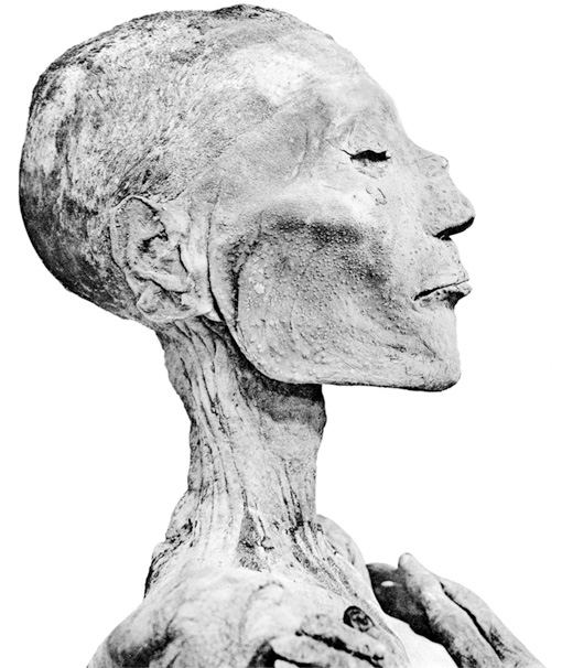 Иллюстрация к книге — Вирусы и эпидемии в истории мира. Прошлое, настоящее и будущее [i_006.jpg]