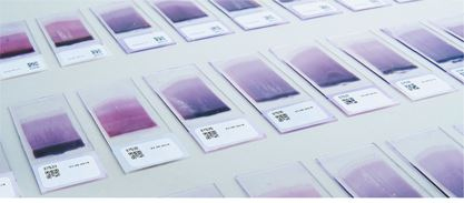 Иллюстрация к книге — Пять литров красного. Что необходимо знать о крови, ее болезнях и лечении [i_045.jpg]