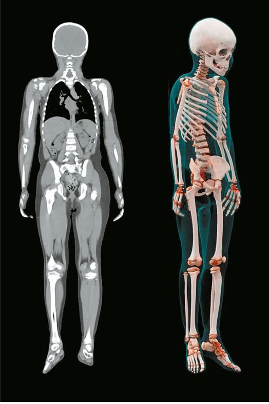 Иллюстрация к книге — Пять литров красного. Что необходимо знать о крови, ее болезнях и лечении [i_057.jpg]