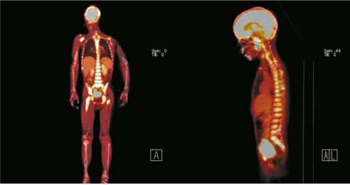 Иллюстрация к книге — Пять литров красного. Что необходимо знать о крови, ее болезнях и лечении [i_059.jpg]