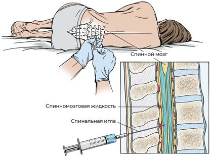 Иллюстрация к книге — Пять литров красного. Что необходимо знать о крови, ее болезнях и лечении [i_110.jpg]