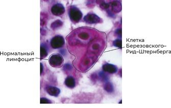 Иллюстрация к книге — Пять литров красного. Что необходимо знать о крови, ее болезнях и лечении [i_127.jpg]