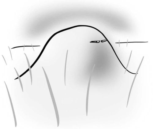 Иллюстрация к книге — PRO здоровье. Перевод с медицинского на человеческий [i_098.jpg]