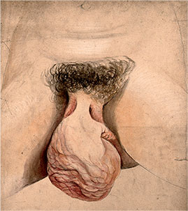 Иллюстрация к книге — Удивительная история секса. Взгляд сквозь века на одну из самых табуированных тем человечества [i_011.jpg]