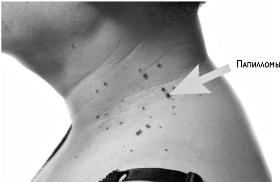 Иллюстрация к книге — В зоне риска. Тонкости защиты женского организма. Как ВПЧ проникает в наш организм, чем он опасен и что поможет избежать последствий [i_029.jpg]