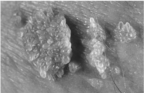 Иллюстрация к книге — В зоне риска. Тонкости защиты женского организма. Как ВПЧ проникает в наш организм, чем он опасен и что поможет избежать последствий [i_030.jpg]