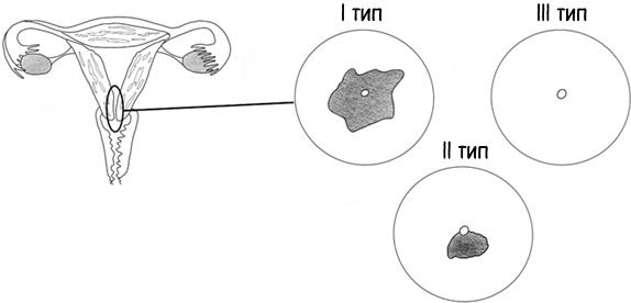 Иллюстрация к книге — В зоне риска. Тонкости защиты женского организма. Как ВПЧ проникает в наш организм, чем он опасен и что поможет избежать последствий [i_041.jpg]
