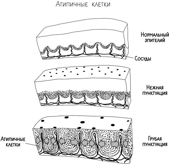 Иллюстрация к книге — В зоне риска. Тонкости защиты женского организма. Как ВПЧ проникает в наш организм, чем он опасен и что поможет избежать последствий [i_042.jpg]