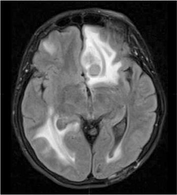 Иллюстрация к книге — Потерявшая разум. Откровенная история нейроученого о болезни, надежде и возвращении [i_006.jpg]