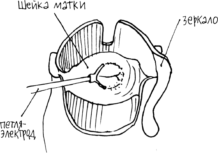 Иллюстрация к книге — 1000 вопросов и ответов по гинекологии [_49.jpg]