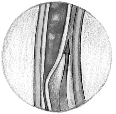 Иллюстрация к книге — Хрупкий мозг. Инсульту не быть? [img_29.jpg]