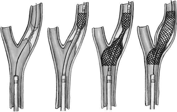 Иллюстрация к книге — Хрупкий мозг. Инсульту не быть? [img_37.jpg]