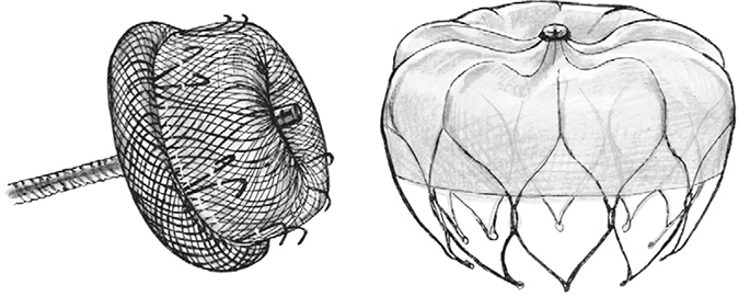 Иллюстрация к книге — Хрупкий мозг. Инсульту не быть? [img_41.jpg]