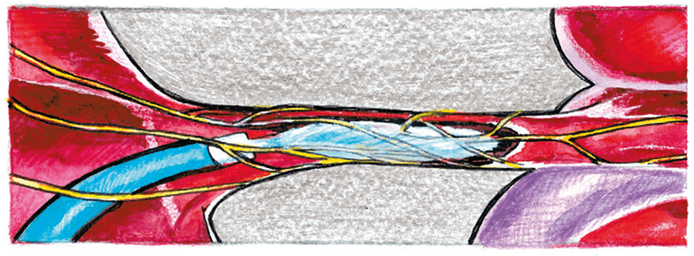 Иллюстрация к книге — Хрупкий мозг. Инсульту не быть? [img_49.jpg]