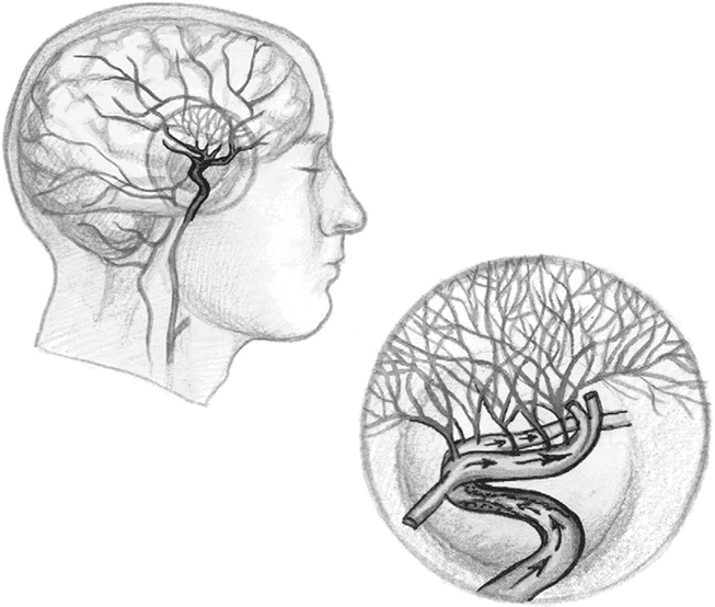 Иллюстрация к книге — Хрупкий мозг. Инсульту не быть? [img_54.jpg]