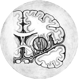 Иллюстрация к книге — Хрупкий мозг. Инсульту не быть? [img_61.jpg]