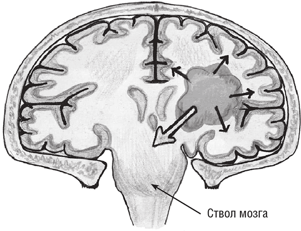 Иллюстрация к книге — Хрупкий мозг. Инсульту не быть? [img_63.jpg]