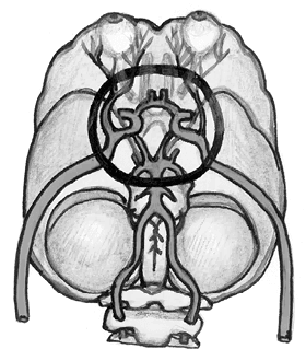 Иллюстрация к книге — Хрупкий мозг. Инсульту не быть? [img_67.jpg]