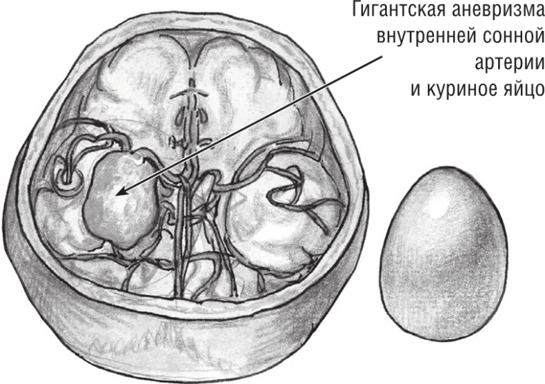 Иллюстрация к книге — Хрупкий мозг. Инсульту не быть? [img_69.jpg]