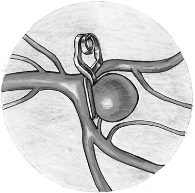 Иллюстрация к книге — Хрупкий мозг. Инсульту не быть? [img_74.jpg]