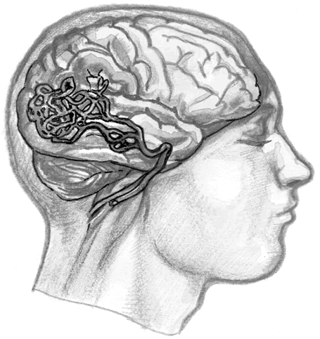 Иллюстрация к книге — Хрупкий мозг. Инсульту не быть? [img_78.jpg]