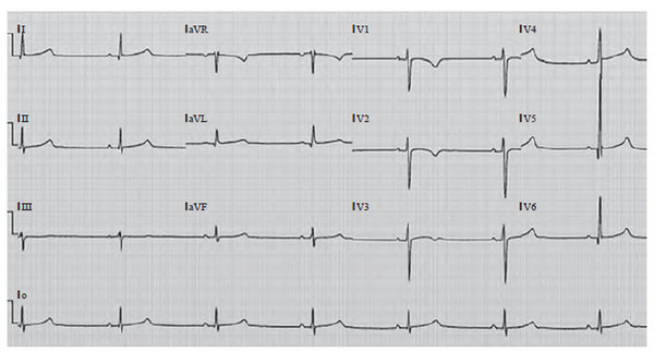 Иллюстрация к книге — Сердце спортсмена. Актуальные проблемы спортивной кардиологии [i_015.jpg]