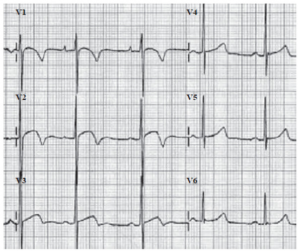 Иллюстрация к книге — Сердце спортсмена. Актуальные проблемы спортивной кардиологии [i_016.jpg]