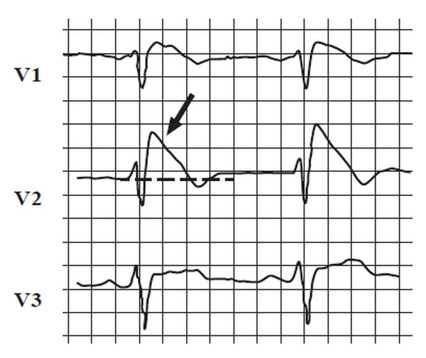 Иллюстрация к книге — Сердце спортсмена. Актуальные проблемы спортивной кардиологии [i_017.jpg]