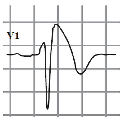 Иллюстрация к книге — Сердце спортсмена. Актуальные проблемы спортивной кардиологии [i_022.jpg]