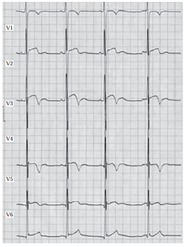 Иллюстрация к книге — Сердце спортсмена. Актуальные проблемы спортивной кардиологии [i_030.jpg]
