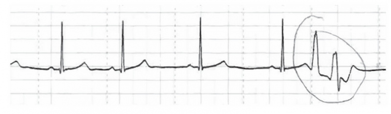 Иллюстрация к книге — Сердце спортсмена. Актуальные проблемы спортивной кардиологии [i_036.jpg]