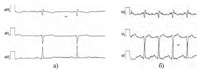 Иллюстрация к книге — Сердце спортсмена. Актуальные проблемы спортивной кардиологии [i_040.jpg]