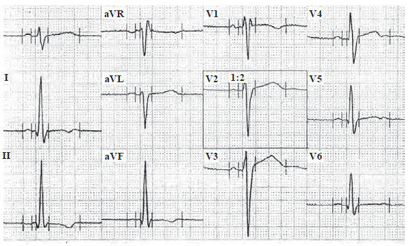 Иллюстрация к книге — Сердце спортсмена. Актуальные проблемы спортивной кардиологии [i_043.jpg]