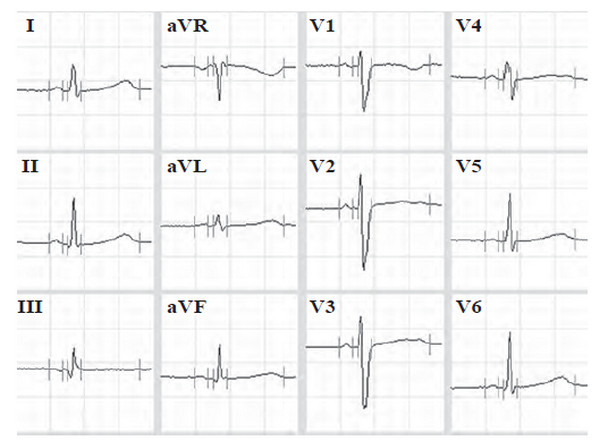 Иллюстрация к книге — Сердце спортсмена. Актуальные проблемы спортивной кардиологии [i_044.jpg]